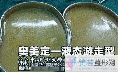 奥美定取出憋拖延，价格再高也要果断！