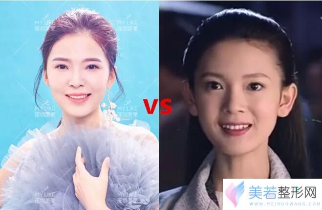 深圳美莱梁晓健
