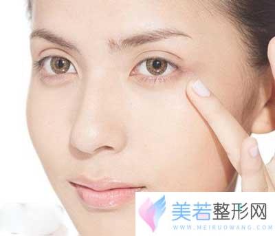 如何改良臃肿眼袋？去眼袋的三个方法