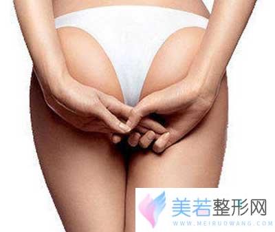 自体脂肪丰臀果怎么样？让臀形更加丰满挺翘!