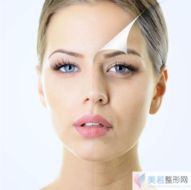 内窥镜除皱术的技术特点和优劣势盘点