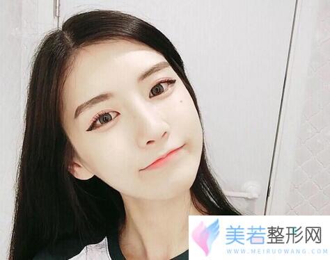 佛山垫个鼻子一般要多少钱
