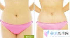 重庆美伽整形医院全新价格表一览