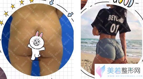 深圳仁安雅苗春来丰臀怎么样