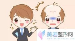 不剃发植发技术是什么？有什么优点？