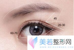 开外眼角会疤痕增生吗 重庆颜语整形医院开眼角价格