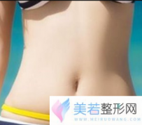 腰腹吸脂减肥价钱 宁德伊凡华美整形医院优惠进行中
