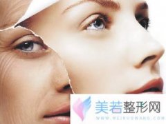 厦门欧尔美整形医院做激光去皱多少钱 除皱果很明X