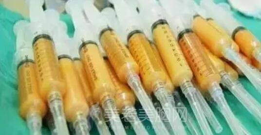 若丽网揭秘:抽脂隆胸的脂肪如何成活