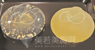 假体复合隆胸术后需要按摩吗?