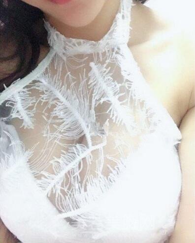 佛山隆胸案例:看我在佛山美莱做的隆胸果图