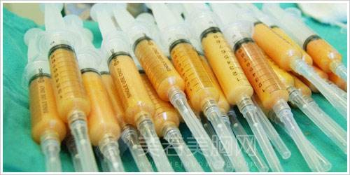 自体脂肪隆胸整形手术价格大概多少钱?