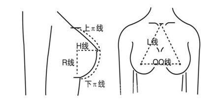 失败隆胸修复术前需要体检吗?禁忌症有哪些?