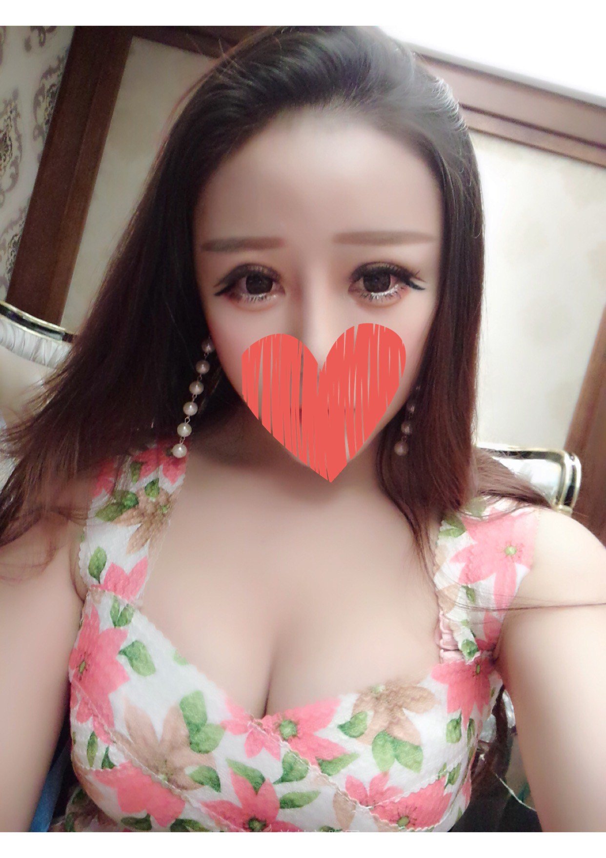 隆胸案例图片|这次让医生给我做了个d罩杯!