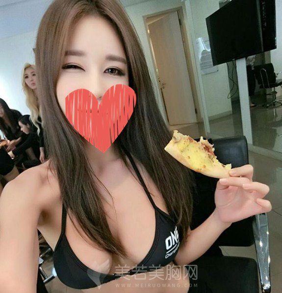自体脂肪隆胸的真实案例,讲讲关于脂肪丰胸体验的事儿!