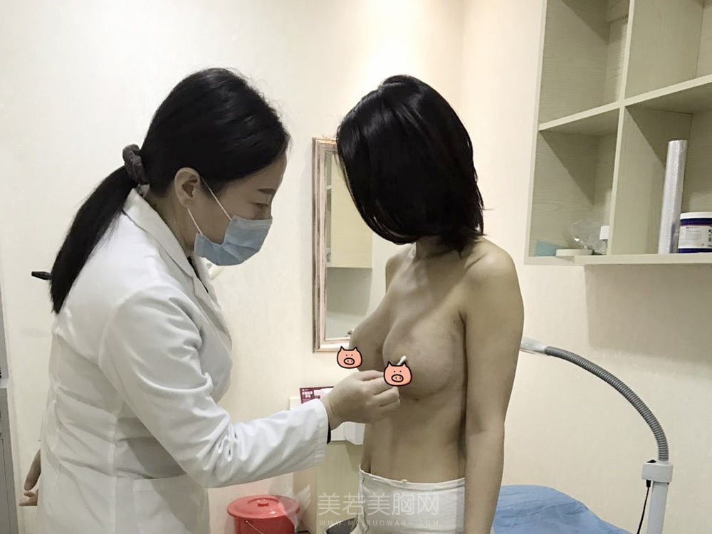 不远千里找到罗盛康做隆胸,案例果图分享!