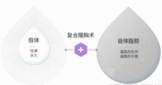 假体隆胸还是复合隆胸好?看完小编觉得复合隆胸更好!