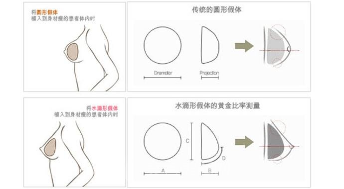 假体硅胶隆胸的手感好吗?性感、手感都要在线!