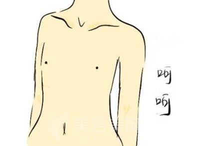 做完隆胸手术之后适合穿哪种内衣?