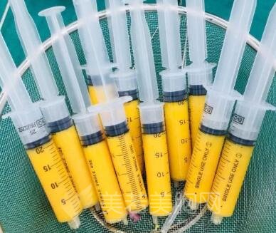 吸脂手术可能存在的一些副作用