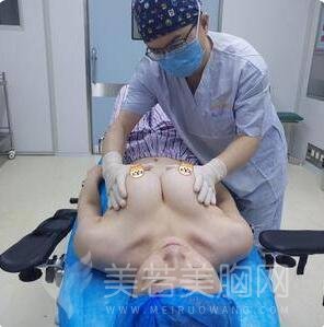 做娜高隆胸手术术后