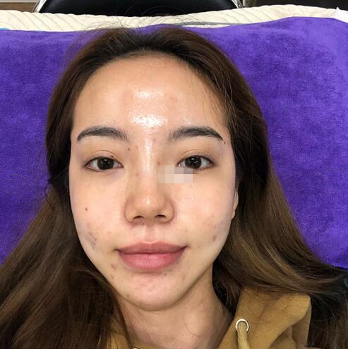 彩光换肤案例