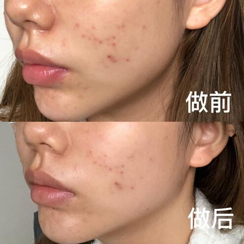 彩光换肤案例