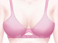 乳晕颜色深怎么办？注意个人卫生很重要