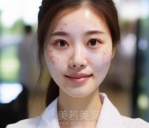 成都中医药大学附属医院祛斑怎么样？分享医院信息-医生推荐