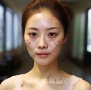 自制去黄褐斑面膜方法有哪些？常见自制去黄褐斑面膜方法分享