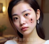 贵州胎记医院哪家最好？一一了解5家热门医院名单