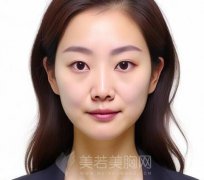 收缩毛孔最有效的方法是什么？明确毛孔粗大的原因分享
