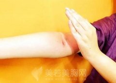 如何瘦手臂？轻松上手的瘦手臂计划，让你自信秀出紧致双臂