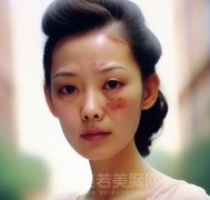 上海去胎记好的医院有哪些？盘点5家人气医院名单
